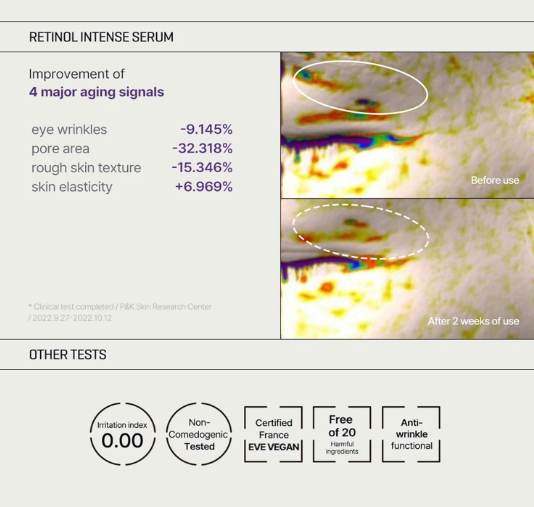 Some By Mi Retinol Intense Trial Kit | 10ml | Mild Korean 0.1% Retinol Face Serum & Eye Cream For Beginner | Fine Lines, Dark Circles, Skin Texture & Elasticity Care